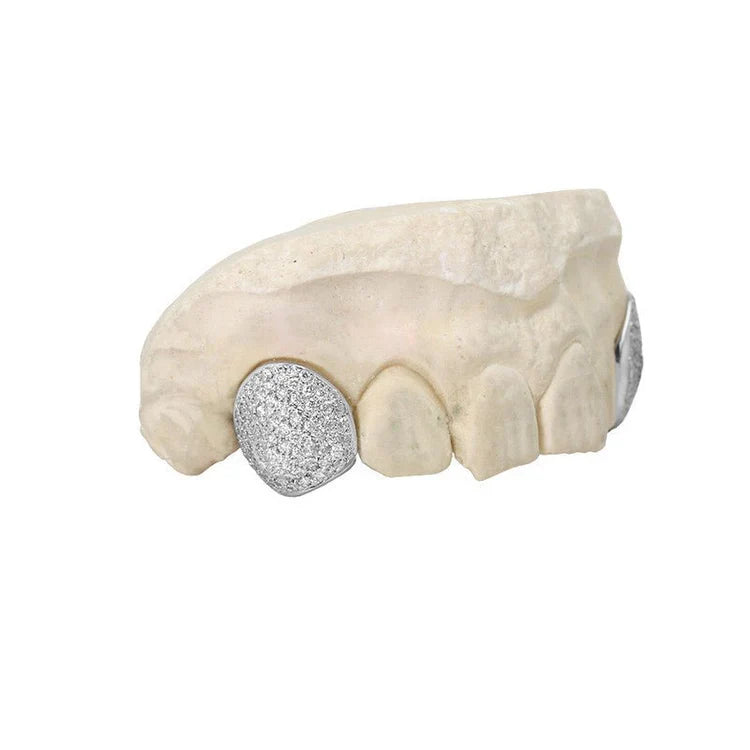 Hydrate Diamonds & Watches: Memphis’s Destination for Custom Grillz & Grillz Repair